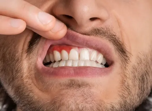 Jak często odwiedzać dentystę, aby zapobiegać nadwrażliwości zębów i chorobom dziąseł?